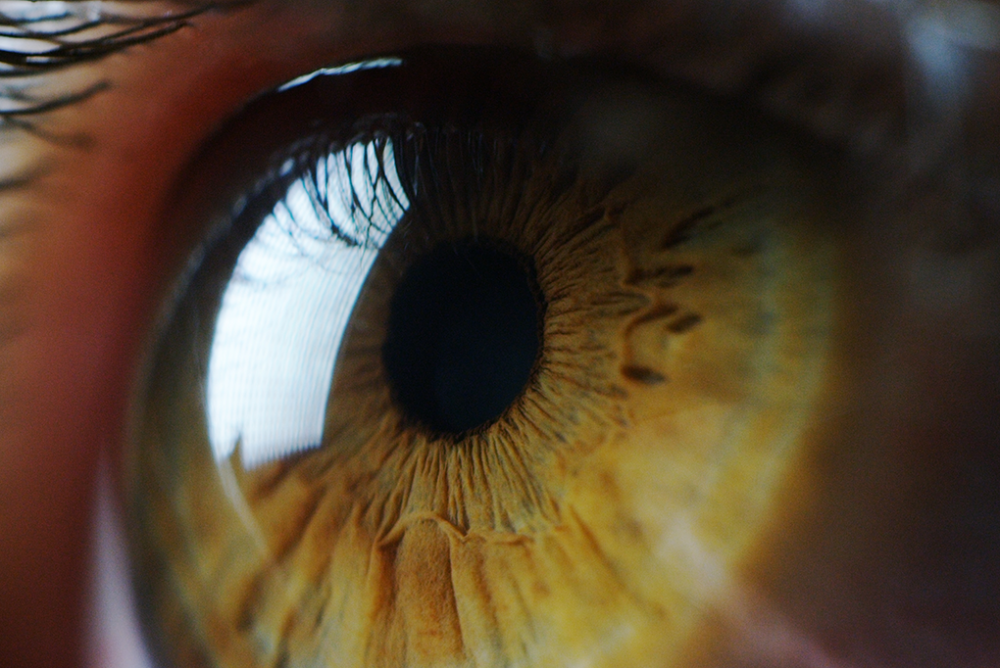 oeil pupille